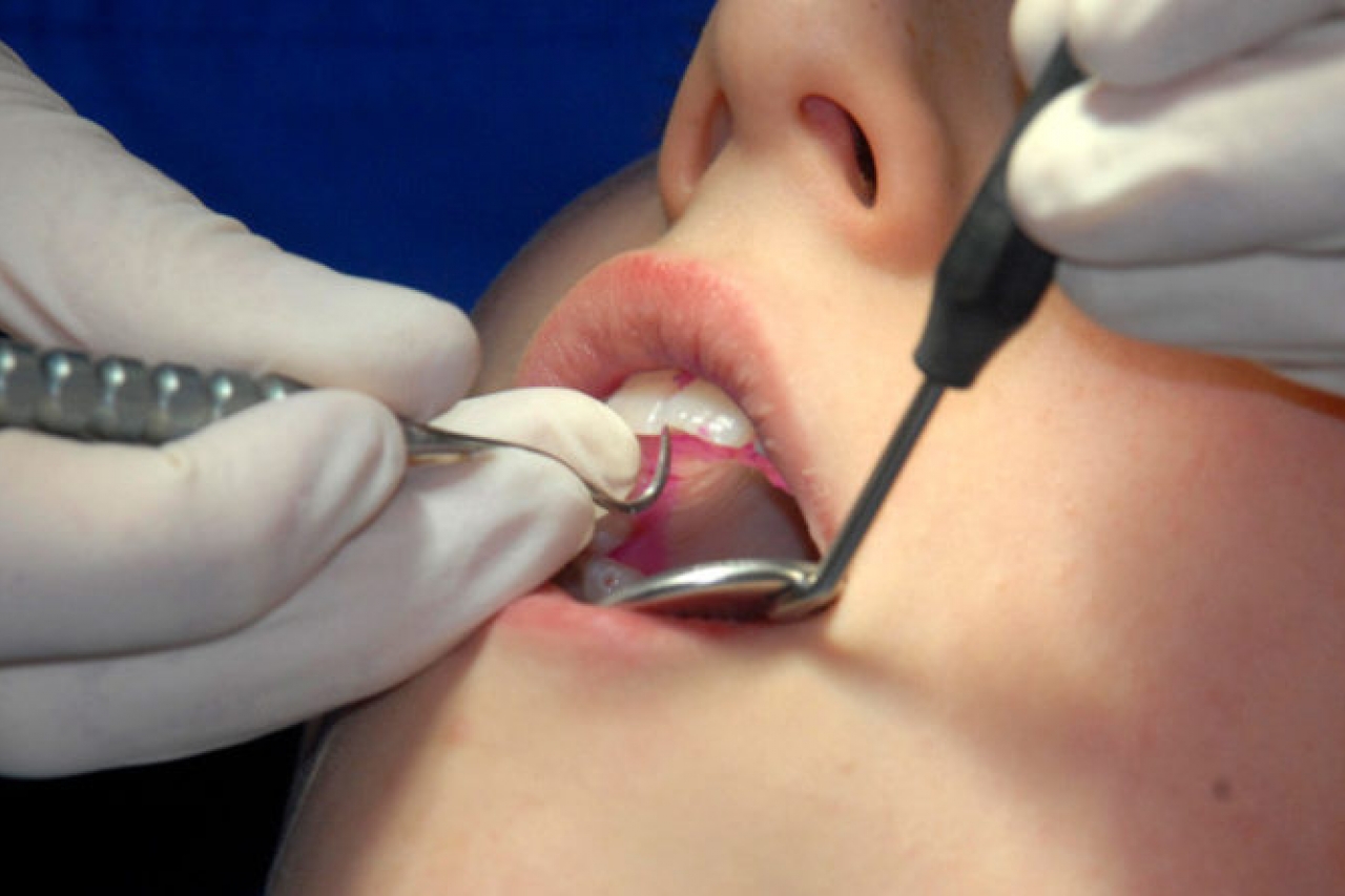 Ofrecen servicios dentales gratuitos en El Paso