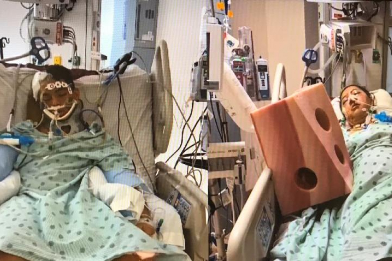 Madre e hijo luchan por su vida después de sufrir un accidente