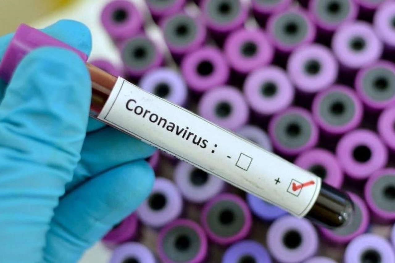 México sin especialistas en coronavirus: AMC