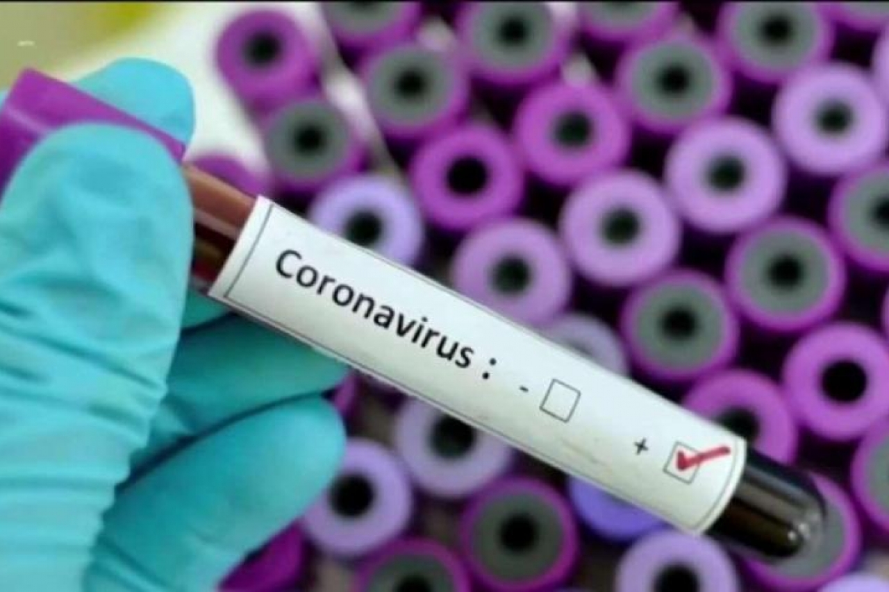 Imparables contagios de coronavirus en El Paso