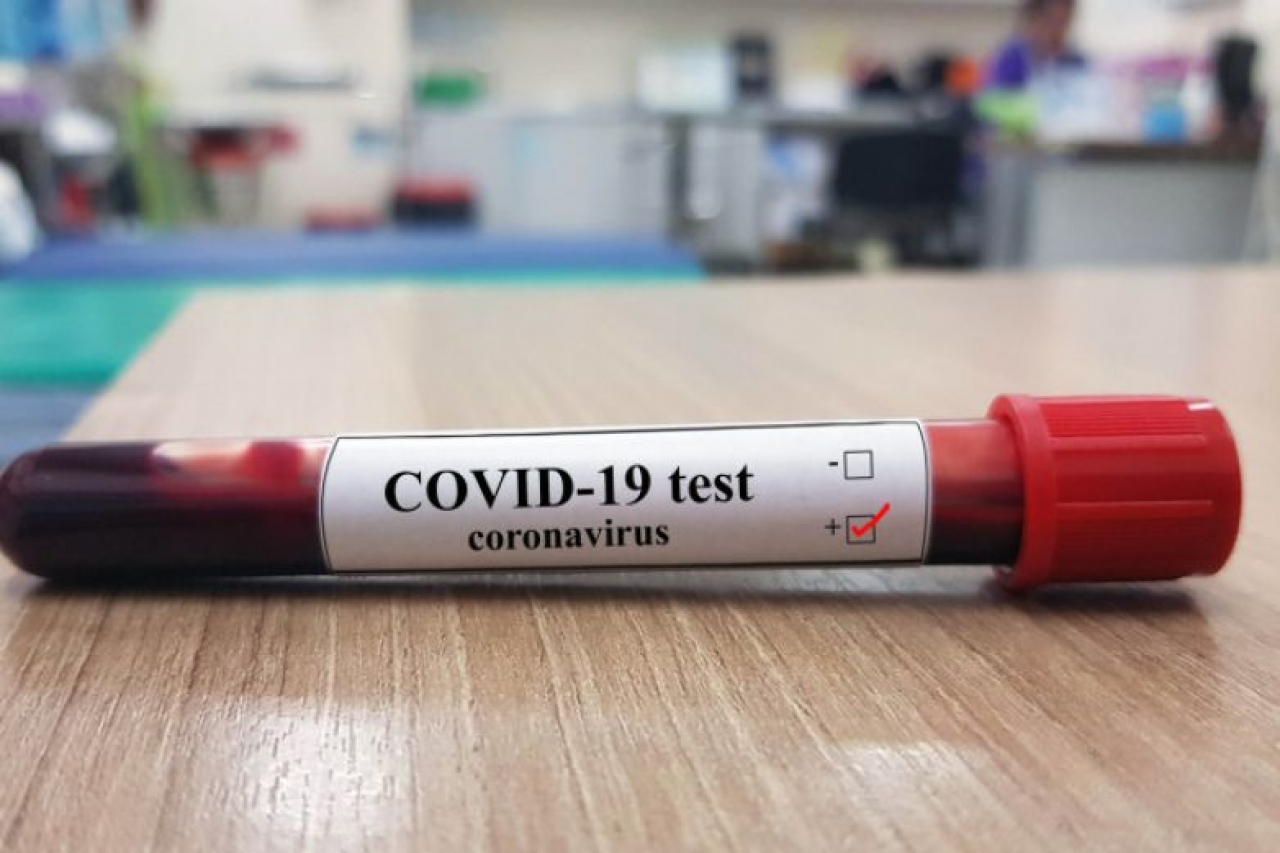Registra El Paso 214 nuevos casos de coronavirus