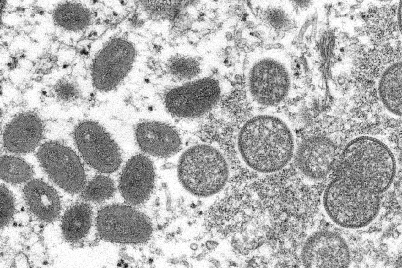 Confirman primeros casos de viruela símica en Colombia