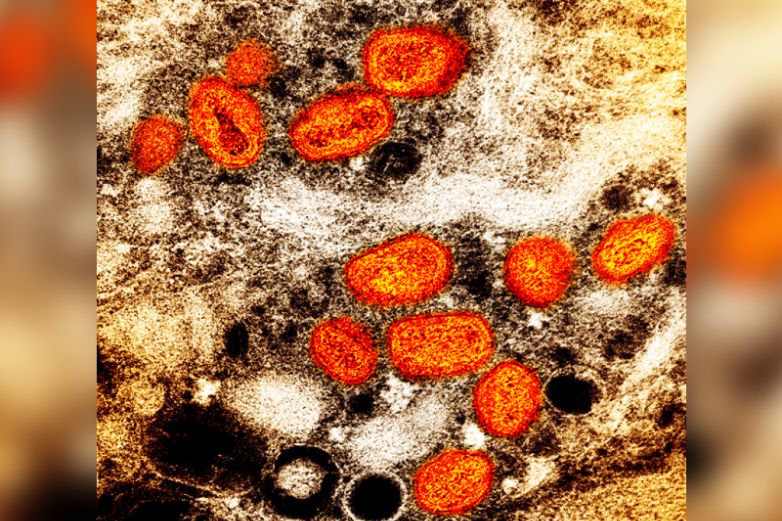 Associated Press | Partículas de viruela símica, en anaranjado, encontradas dentro de una célula