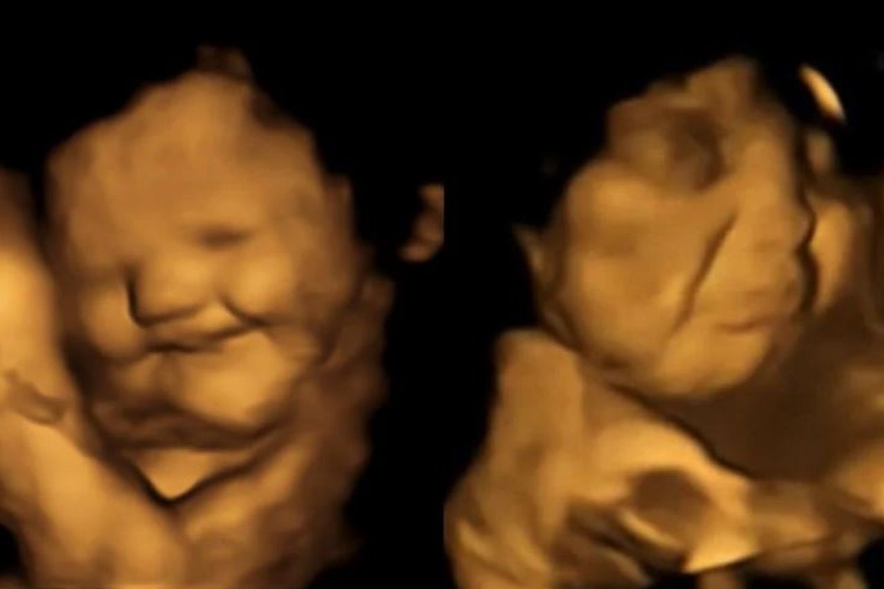 Bebés en el vientre sonríen cuando mamás comen zanahorias: estudio