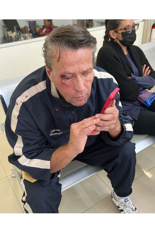 Foto ¡No sirvió el karate! Alfredo Adame es brutalmente golpeado