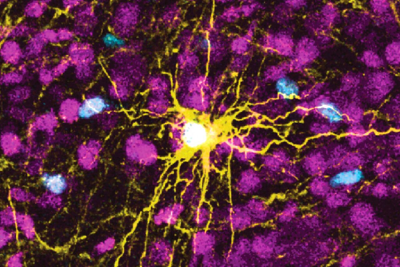 Crean microrrobots para combatir a las células cancerígenas