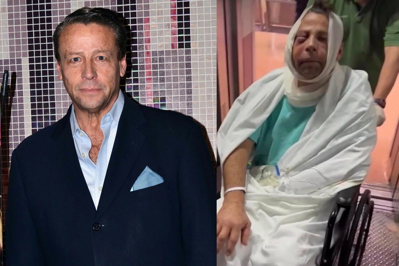 Alfredo Adame sale del hospital tras cirugía en la cara