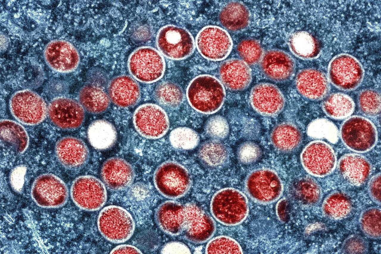 Confirman primera muerte por caso de viruela de Alaska