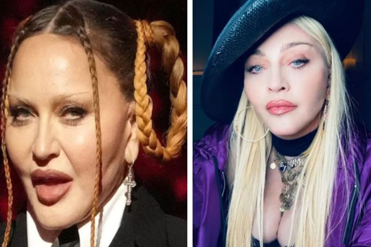 ¿Qué le pasó, abusó del Botox? Critican apariencia de Madonna