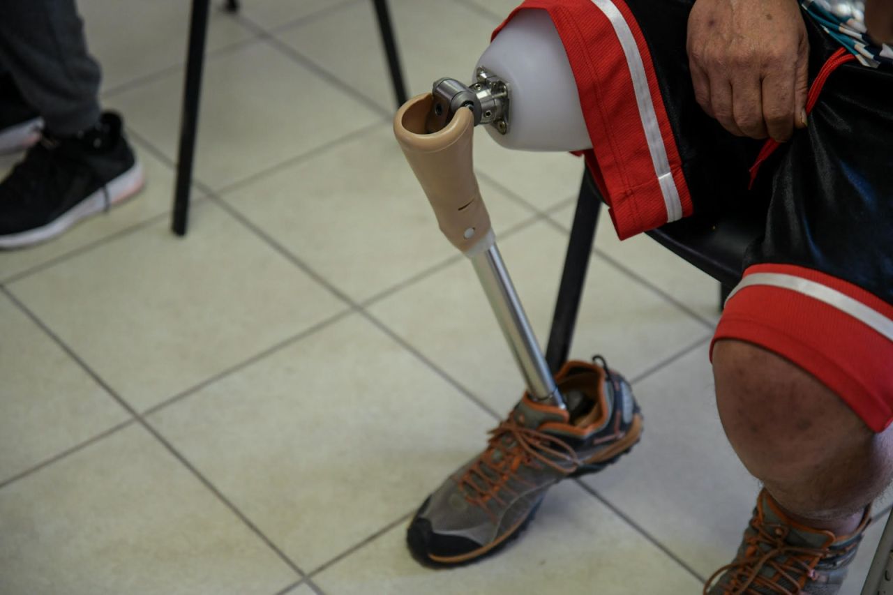 Entrega DIF Estatal 11 prótesis en Juárez a personas con discapacidad