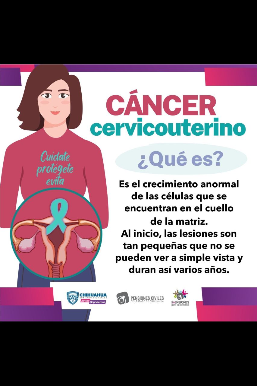 Invitan A Mujeres A Detectar Y Prevenir El Cáncer Cervicouterino 6086