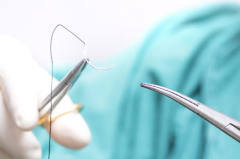Crean nuevas suturas inteligentes derivadas de tejido animal 