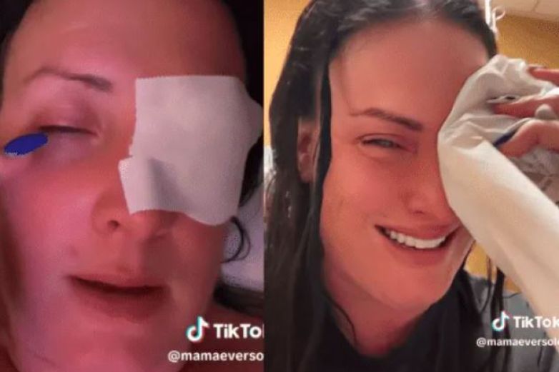 Mujer confunde gotas para los ojos con pegamento para uñas