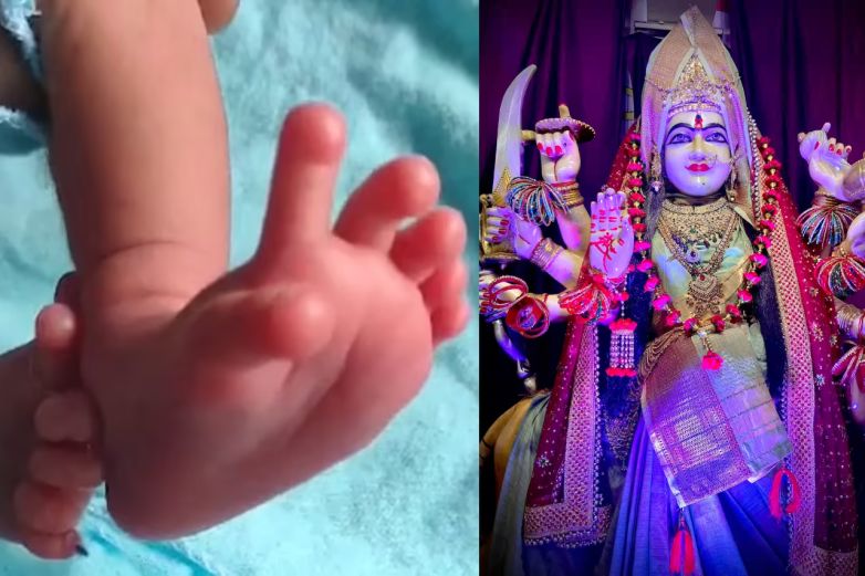Niño con 26 dedos se convierte en una divinidad en India