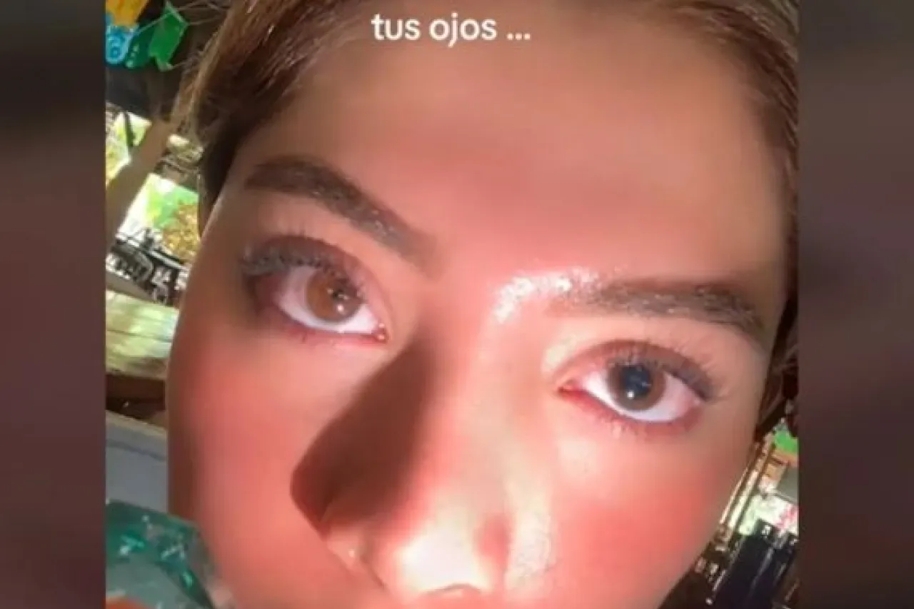 Mujer muestra ‘pupilas deformes’ tras ver el eclipse