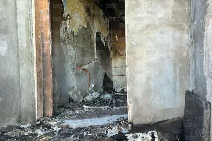 Incendio en vivienda de la San Antonio deja a mujer lesionada