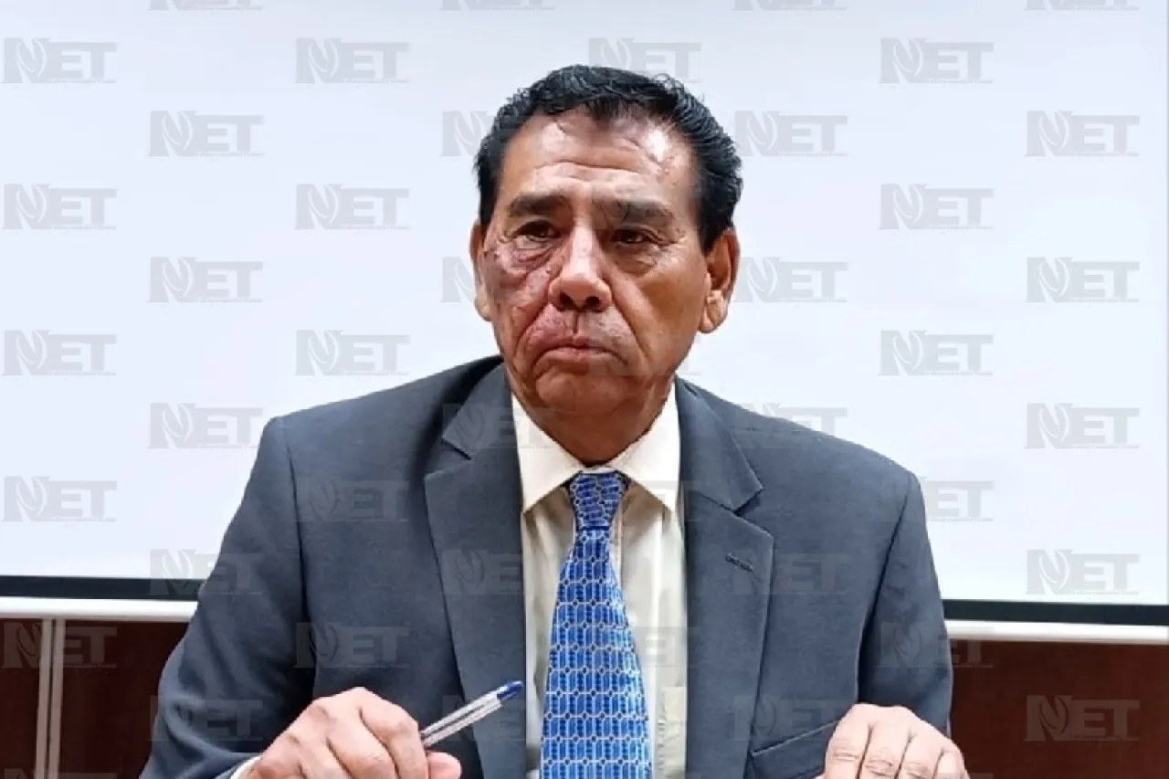 Juárez: Acusa alcalde a oposición de usar al gobierno en proceso electoral