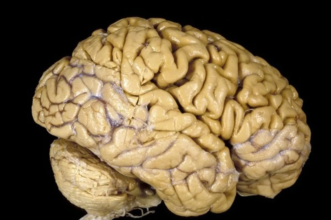 Descubren que el cerebro humano ha crecido, pero no así la inteligencia