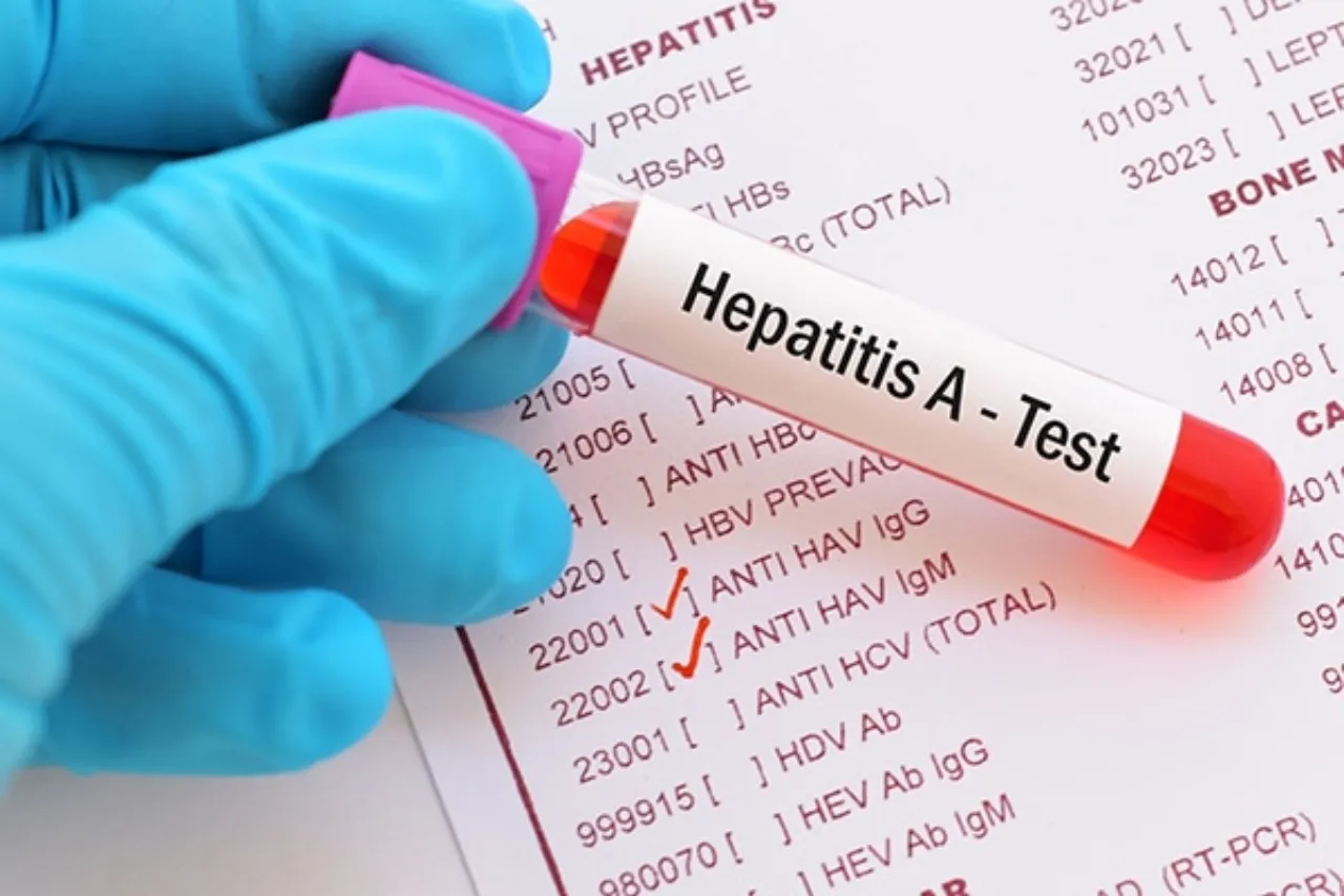 Advierte gobierno de Chiapas por aumento de casos de hepatitis A