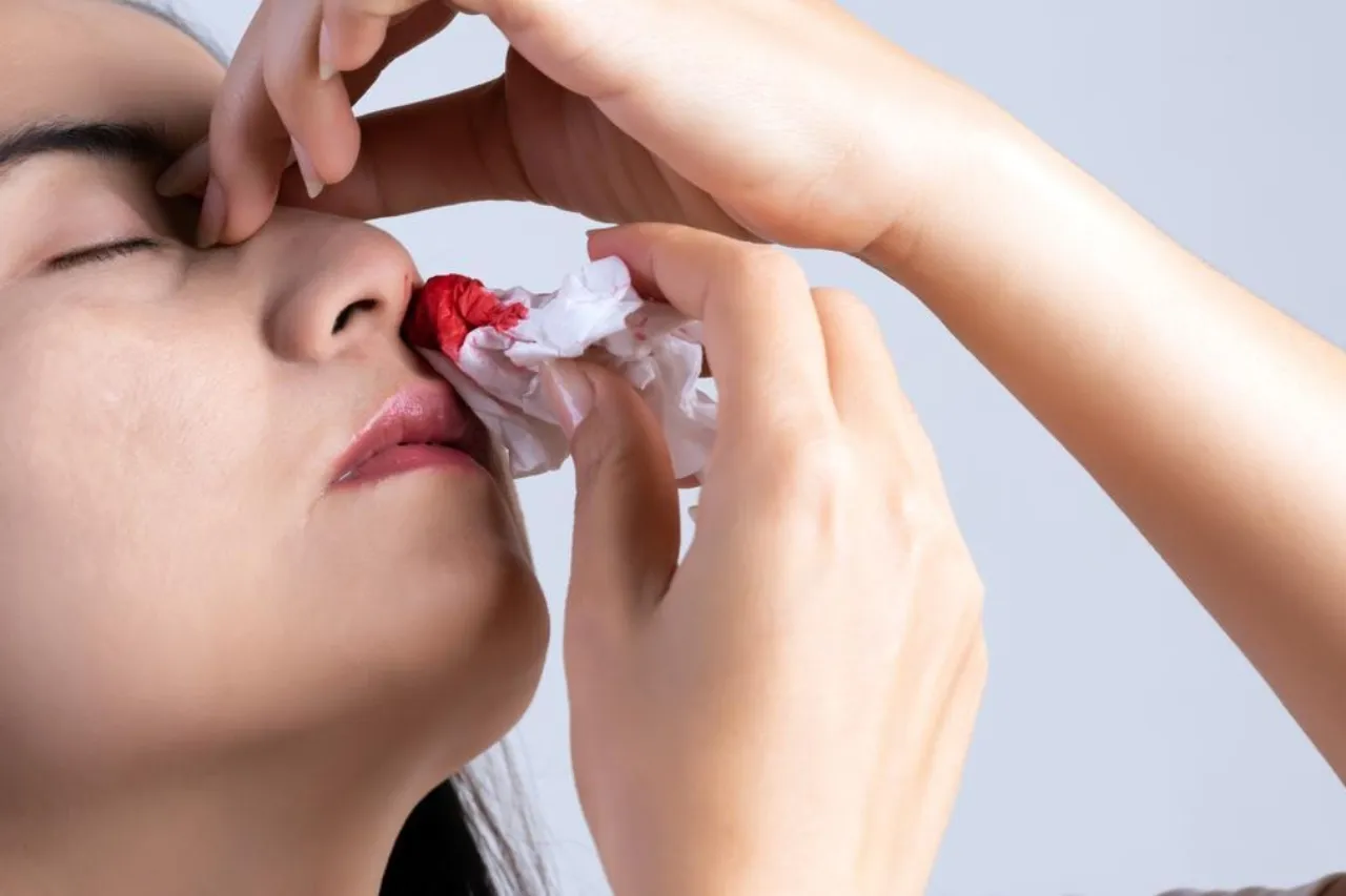 Cuida tu nariz de los sangrados repentinos durante las olas de calor