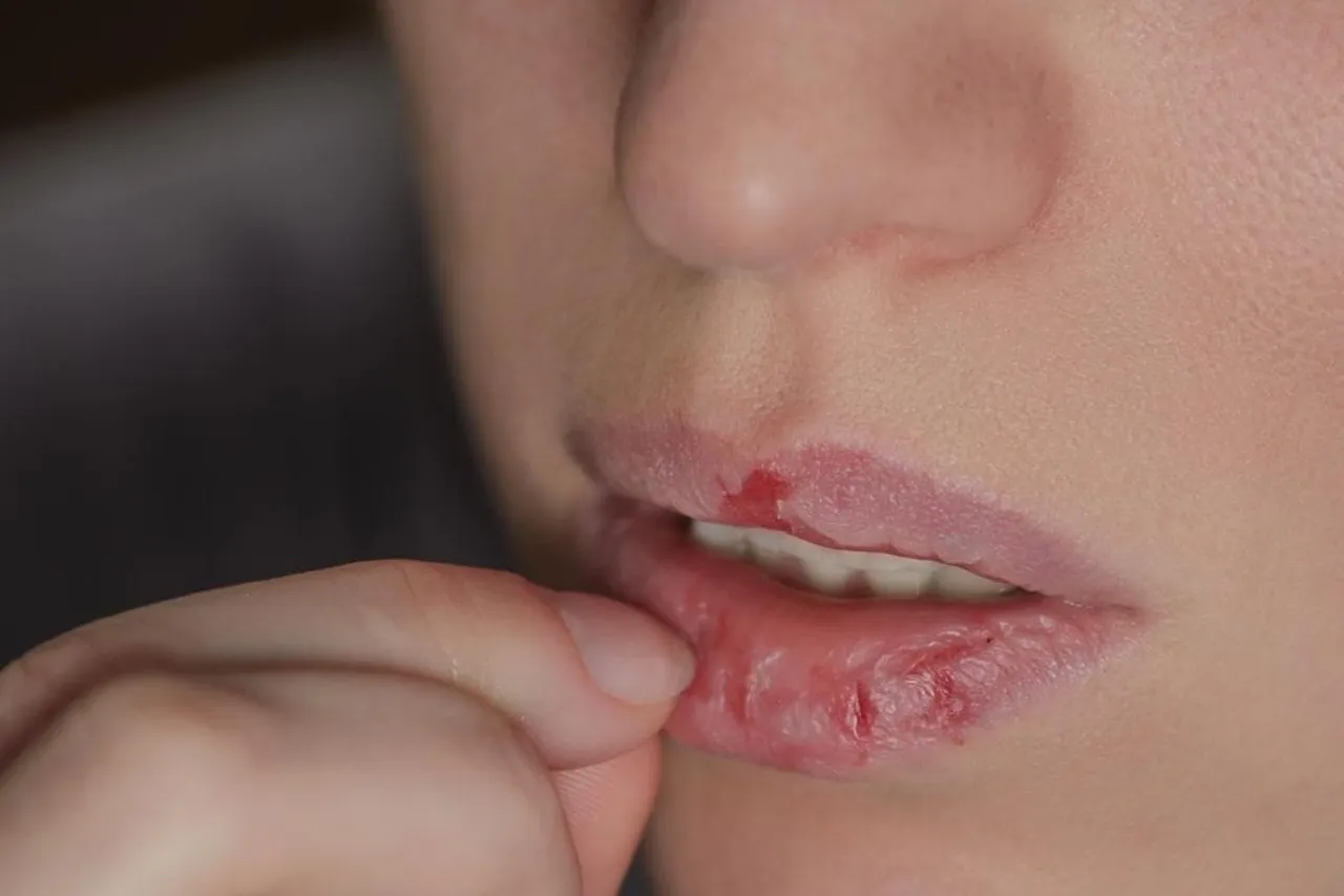 Morderse los labios, un hábito que puede indicar otros problemas más graves
