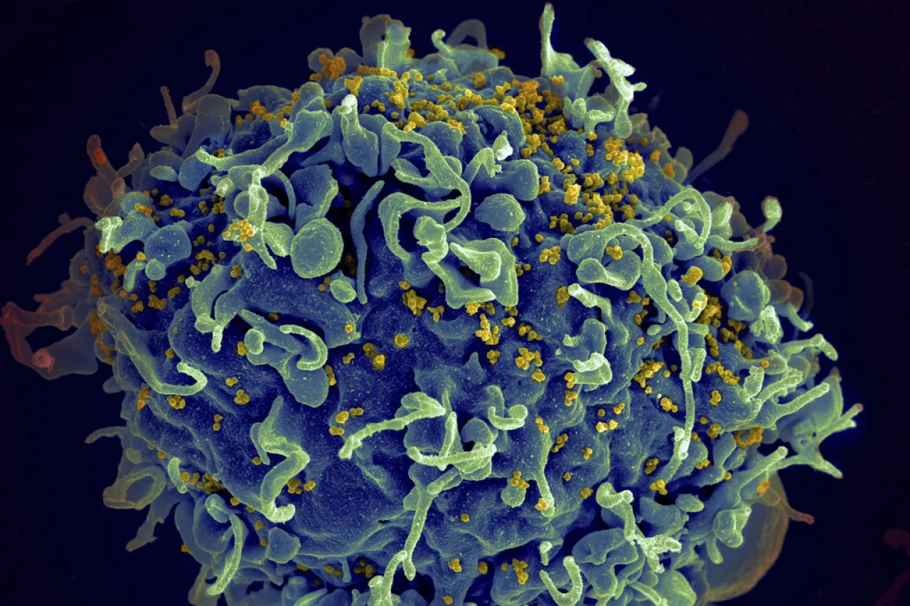 Casi 40 millones de personas tenían VIH en 2023, y cada minuto murió alguien
