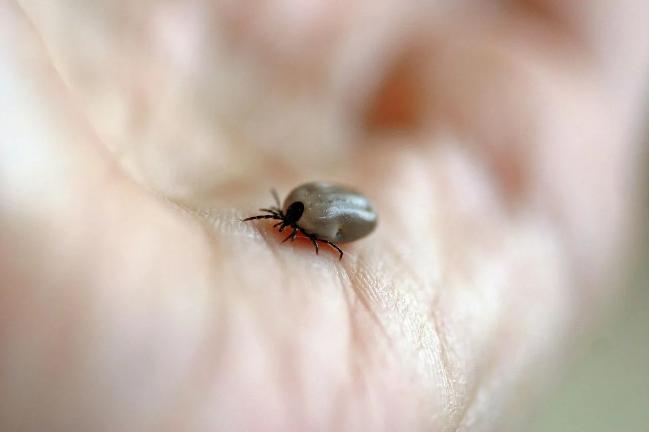 ¡Ojo con los síntomas! Podría ser rickettsia