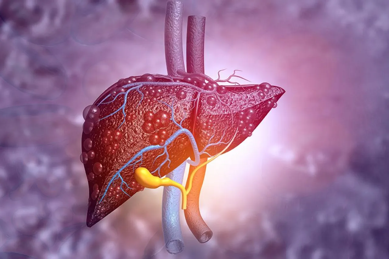 Da PCE medidas para evitar el contagio de hepatitis
