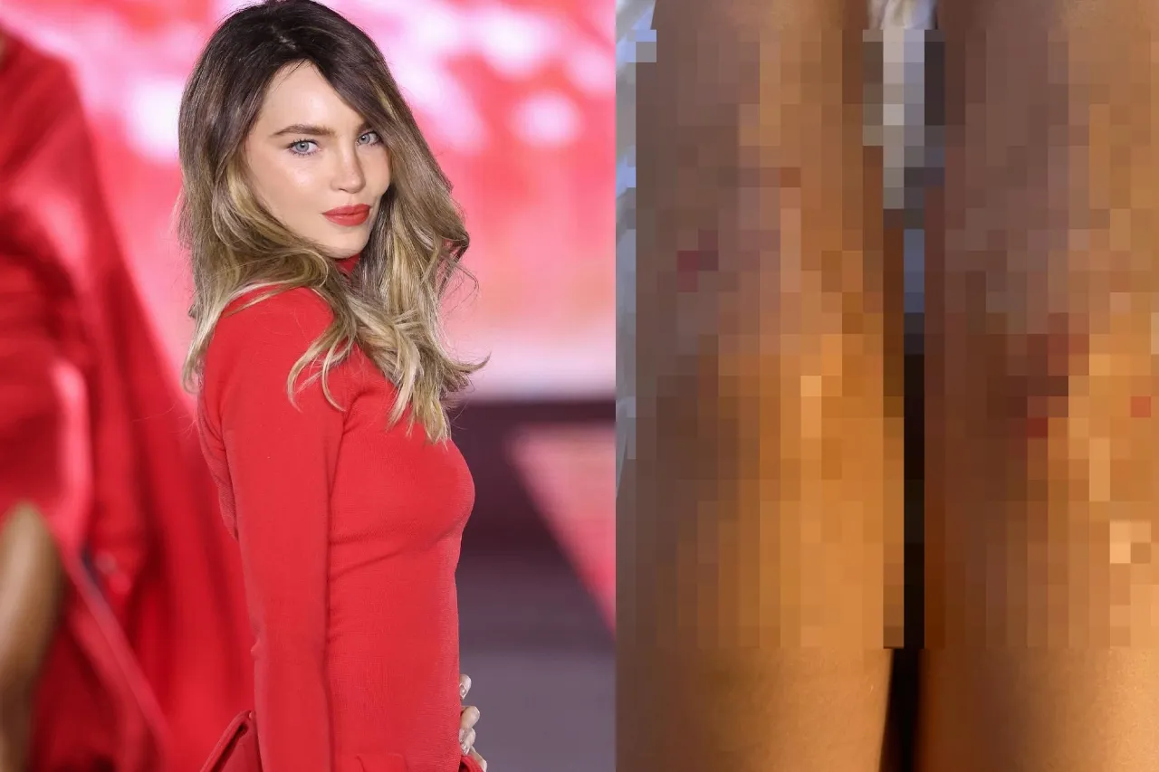 Belinda muestra cómo quedaron sus piernas tras aparatosa caída en desfile