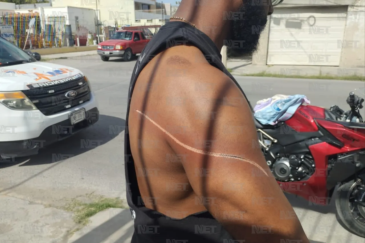 Video: Cable lesiona a conductor de motocicleta y niña de 8 años