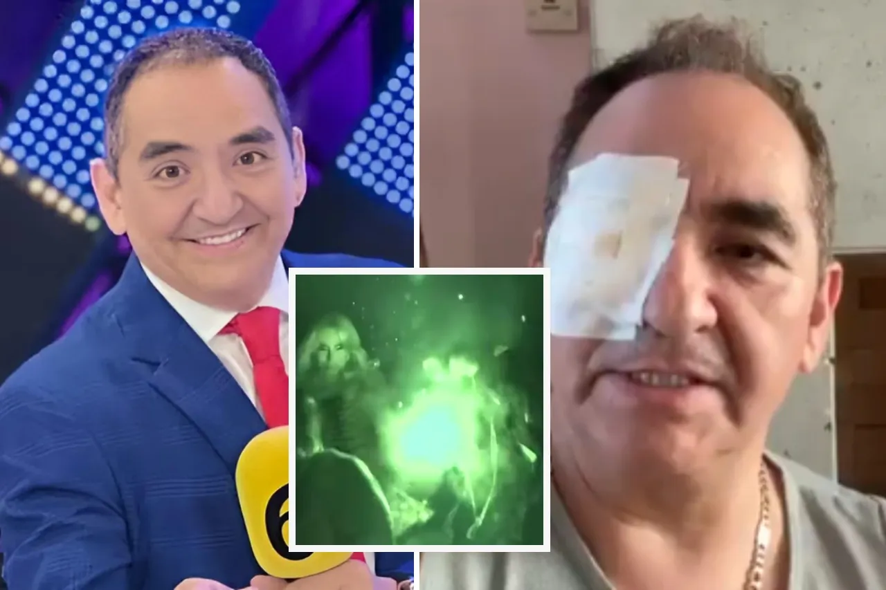 Conductor de Multimedios casi pierde un ojo por una broma durante reality