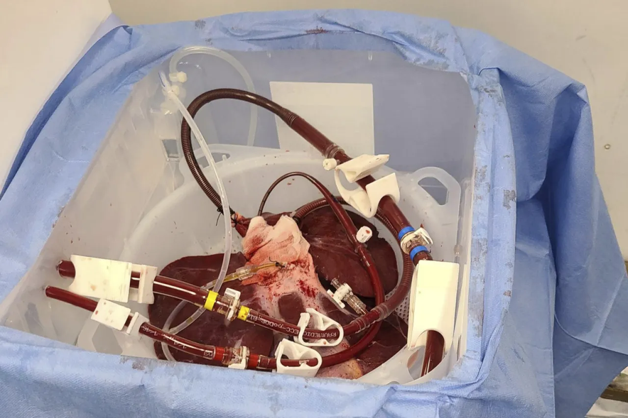 Probarán si hígado de cerdo puede usarse para tratamiento similar a diálisis