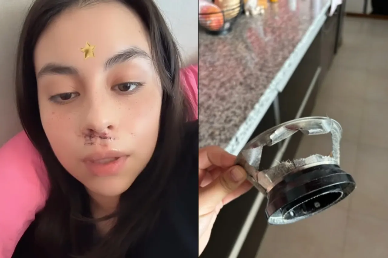 'Navaja salió disparada a mi cara'; joven casi muere por un extractor de jugos