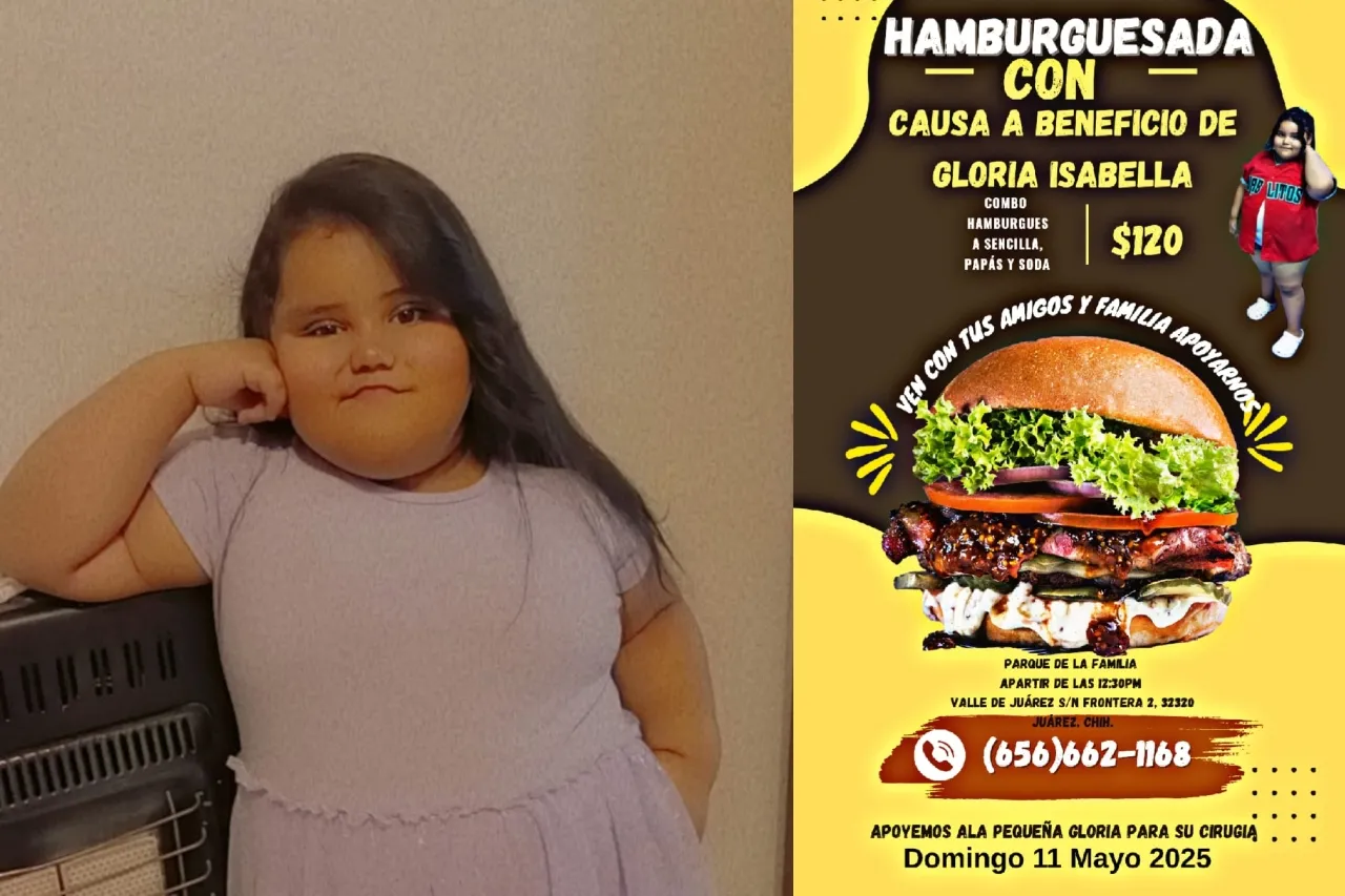 Invitan a hamburguesada para Gloria Isabella; necesita cirugía urgente