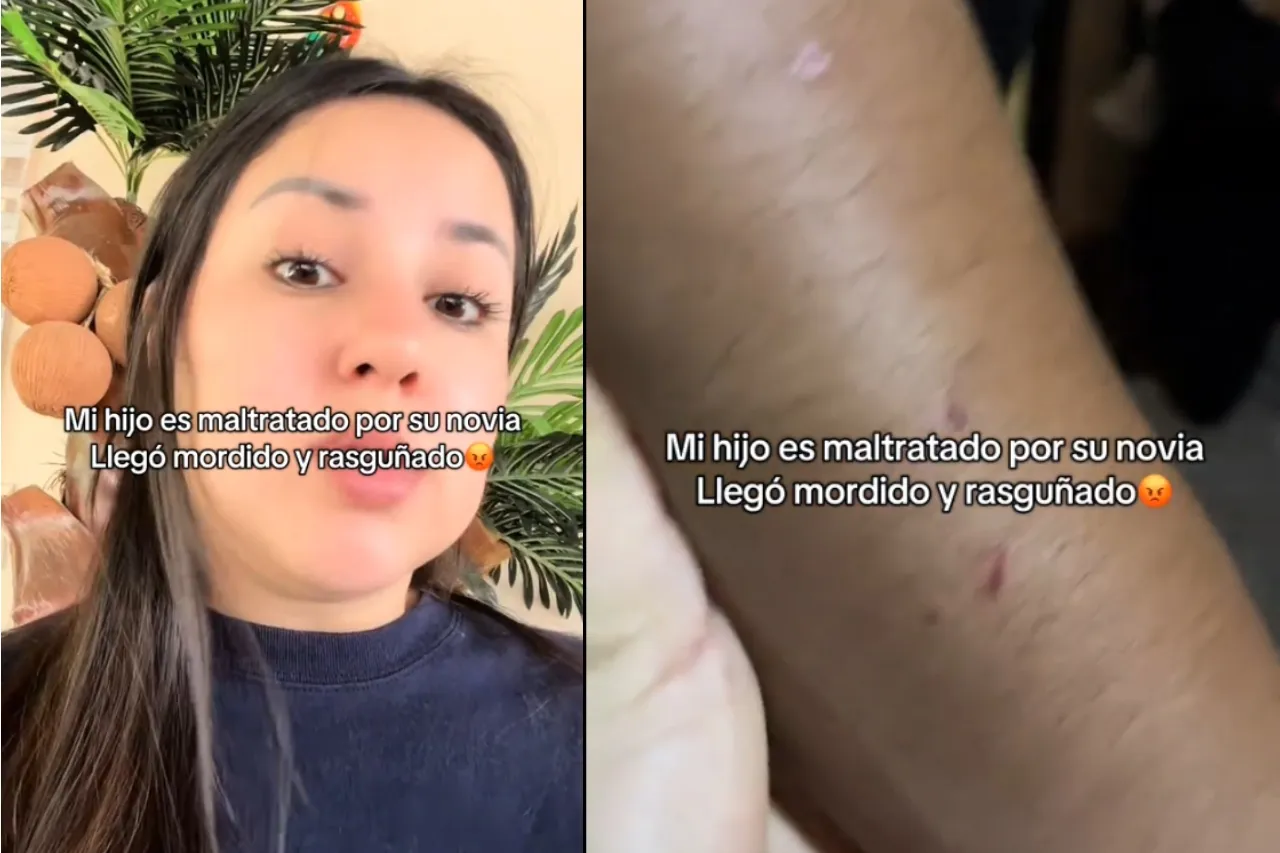 'Llegó mordido y rasguñado'; madre denuncia a novia de su hijo por maltrato