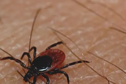 Mantienen autoridades alerta por rickettsia: Conoce los síntomas y riesgos