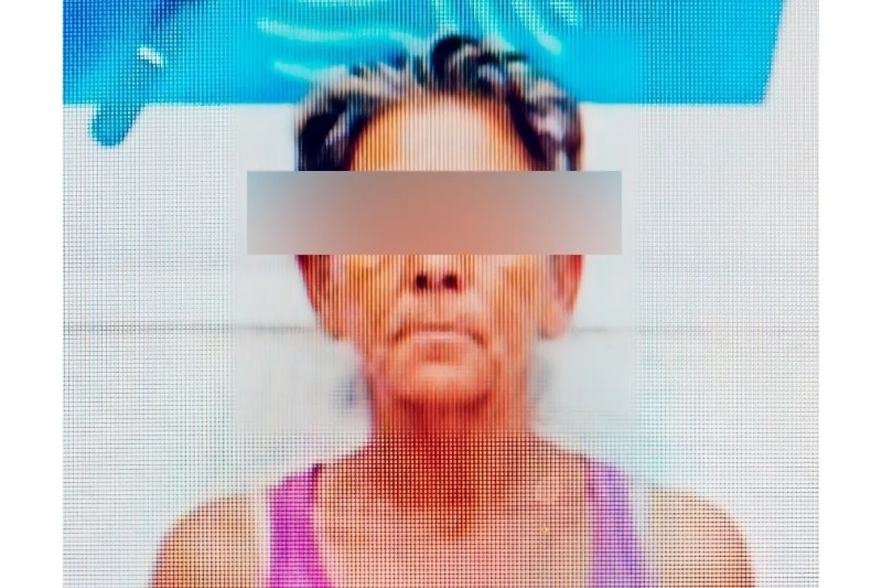 Enfrentará proceso penal por intentar privar de la vida a su ex pareja con fuego