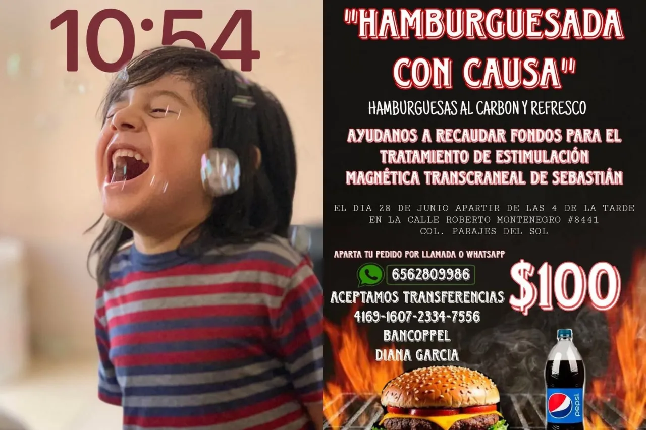 Invitan a hamburguesada con causa para costear tratamiento del niño Sebastián