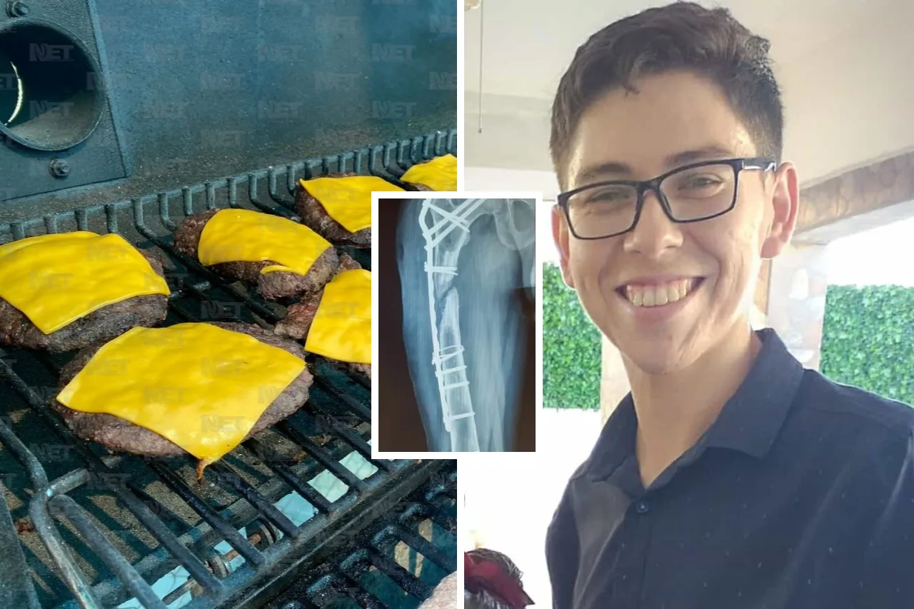 Invitan a hamburguesada a beneficio de Javier; requiere cirugía tras accidente