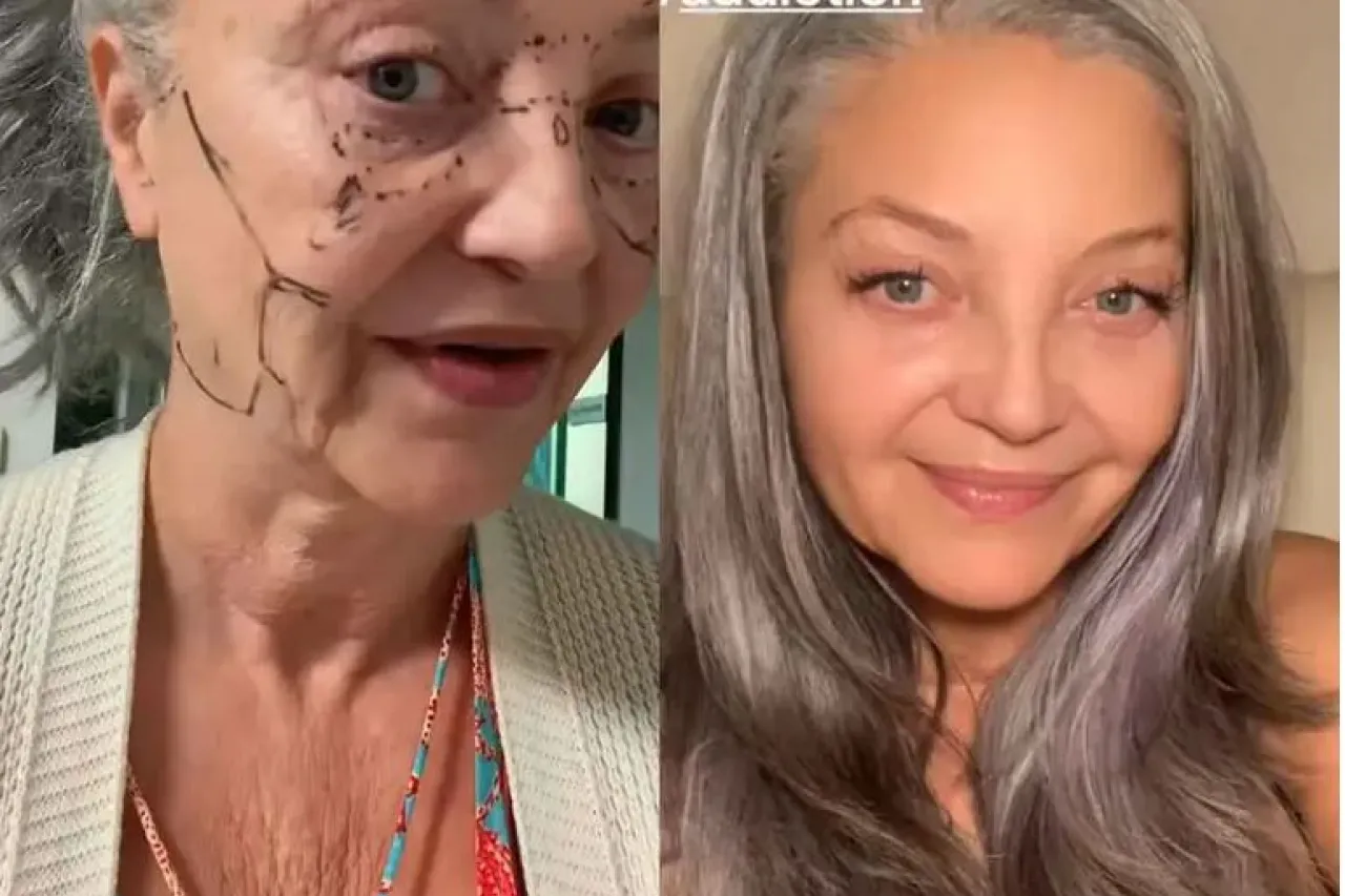 ¿Sugar granny? Abuelita de 55 años se somete a cirugía facial y así queda