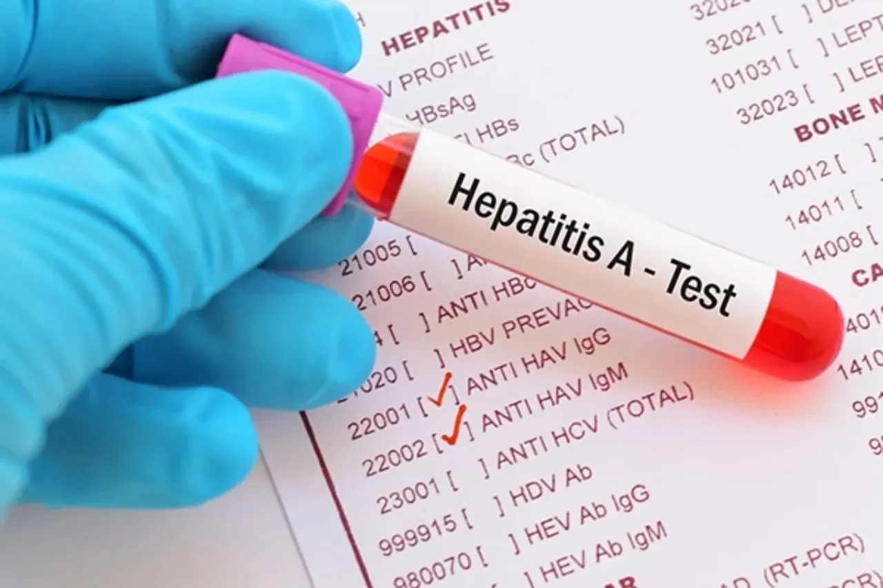 Concentra Juárez 72% de los casos de hepatitis en el estado