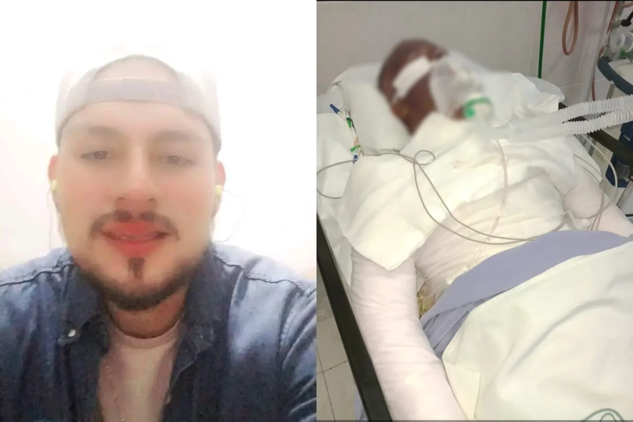 Le arroja gasolina y prende fuego al ex de su novia por ataque de celos
