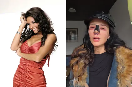 Dorismar confirma mala praxis en cirugía estética y busca corrección en Colombia