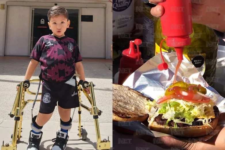 Realizan hamburguesada a beneficio de Mikel, necesita cirugía