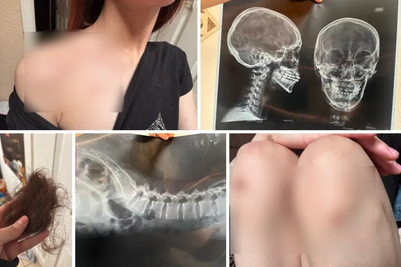 Denuncia joven golpiza afuera de antro en Juárez